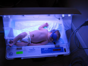 baby-treatment-phototherapy