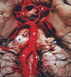 Human base of brain blood supply
