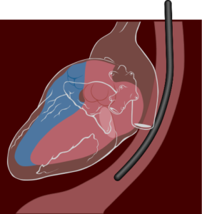 transesophageal echocardiography diagram