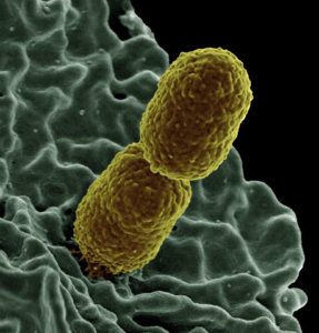 Klebsiella pneumoniae bacterium