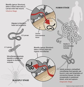 life cycle of onchocerca volvulus