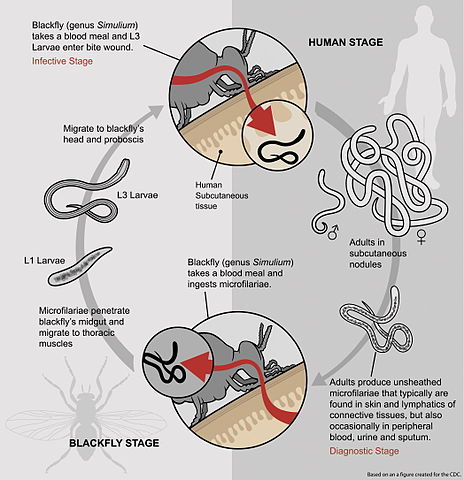 Schistosomiasis usmle, Áttétes rák jelentése