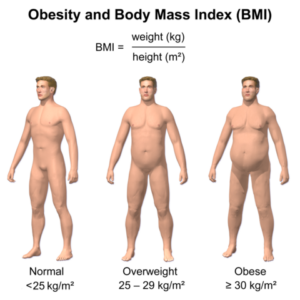 Obesity & BMI