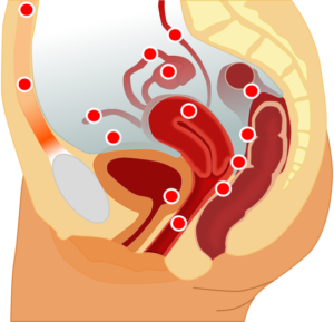 localisation of endometriosis