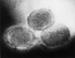 Poxvirus of molluscum contagiosum