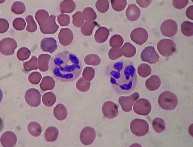 Segmented neutrophils