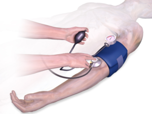 image showing the stethoscope being placed on the cubital fossa for auscultating the brachial artery during blood pressure measurement