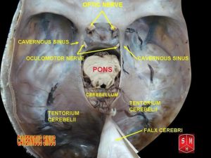 cavernous sinus