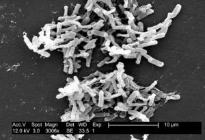 clostridium difficile stool sample
