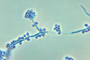 conidiophores and conidia of the fungus sporothrix schenckii