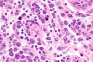 By Nephron - Own work, CC BY-SA 3.0, https://commons.wikimedia.org/w/index.php?curid=42936324