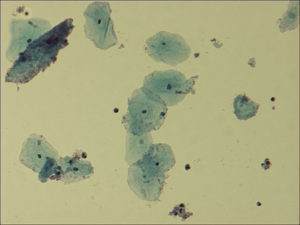 gardnerella vaginalis
