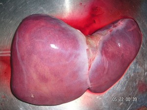 Picture of a human liver