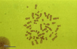 Human-karyotype-46,XY-(man)