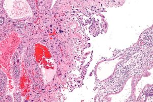 intermediate trophoblast