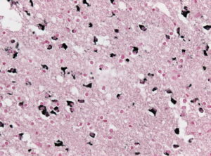 MSA Gallays Papp Lantos inclusions
