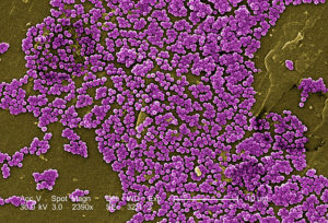 Methicillin-resistant staphylococcus aureus