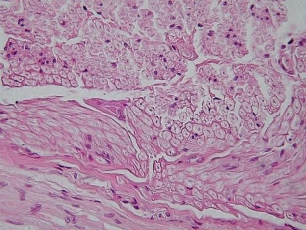 Peripheral nerve cross section nerve tissue