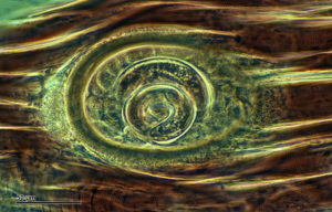 trichinella spiralis in muscle tissue
