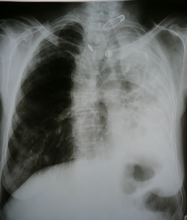 how-long-do-you-get-in-jail-for-vehicular-manslaughter