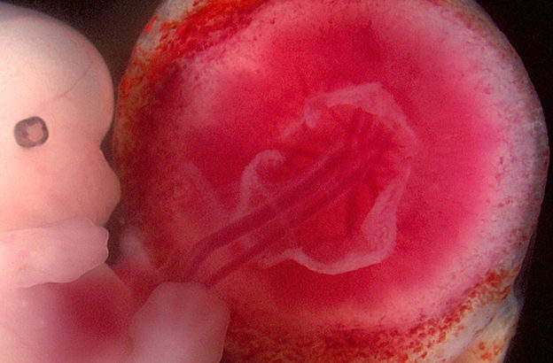 Fetus and placenta