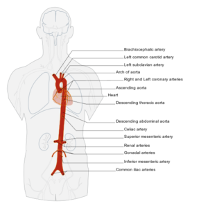 Aorta_scheme_en