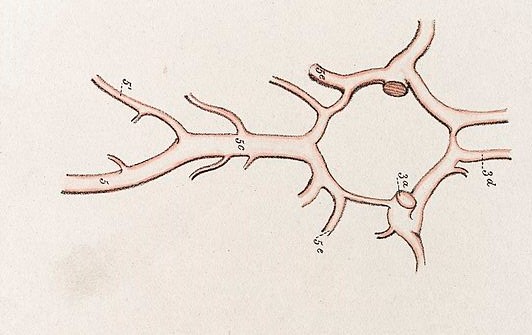 Circle of Willis