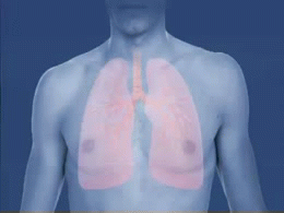 Asthma-attack-airway