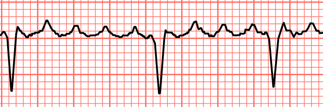 How To Interpret An Ecg In Seven Steps Online Medical Library
