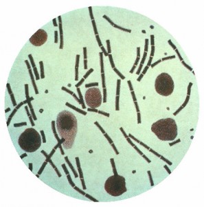 Image: "Bacillus anthracis". License: Public Domain