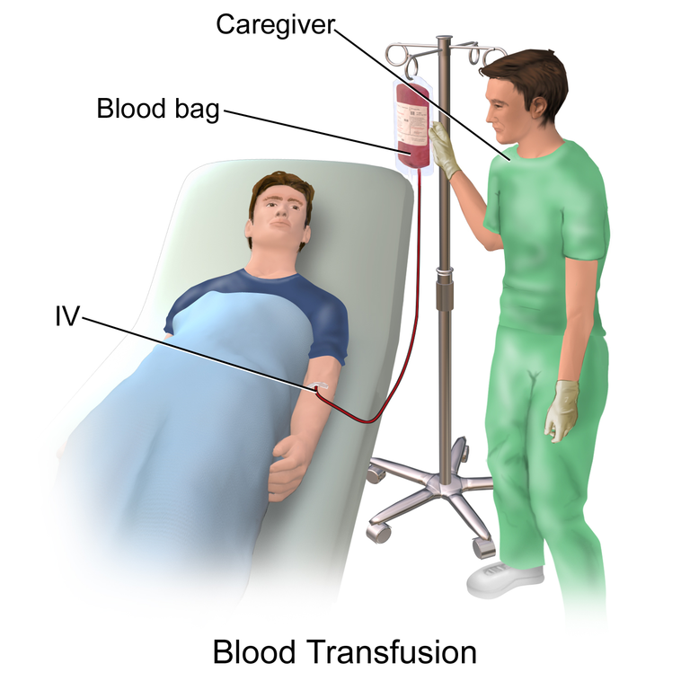 acute-blood-loss-causes-symptoms-and-treatments-medical-library