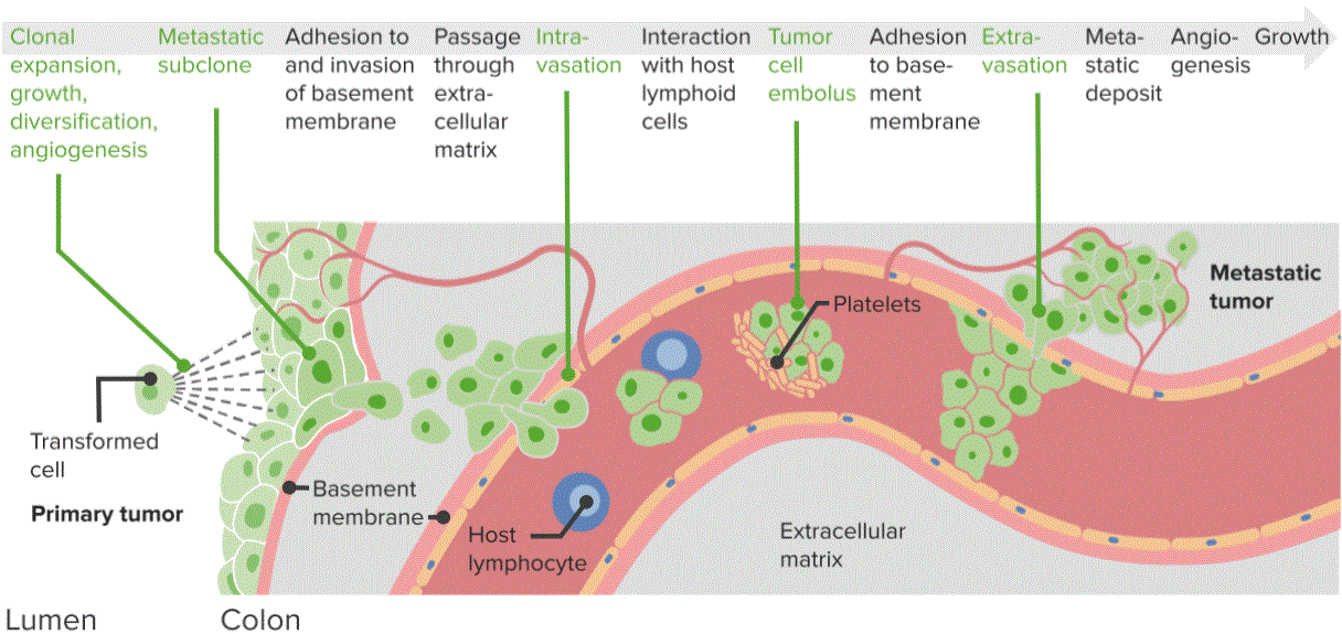 Maligant Neoplasms