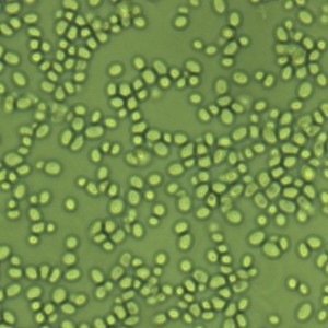 Candida glabrata