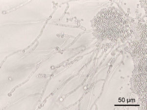 candida albicans