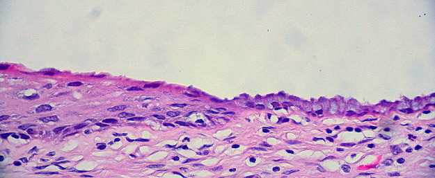 Cervix Normal Squamocolumnar Junction