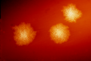 Clostridium difficile colonies