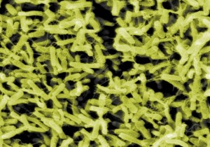 Clostridium Difficile Clostridium Difficile