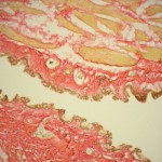 Colored bronchi of ostrich Colored bronchi of ostrich