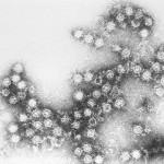 Coxsackie Virus