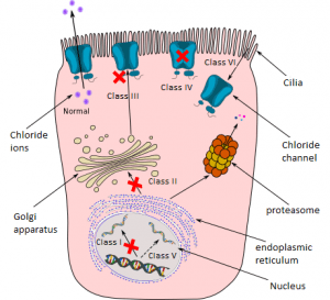 Cystic Fibrosis