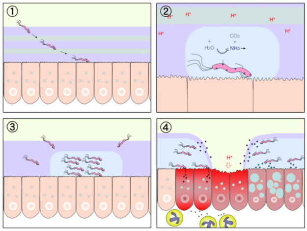 Diagram of gastric ulceration by H. pylori, with minimal annotation