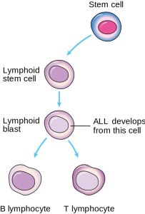 Acute Lymphoblastic Leukemia (ALL) — Survival Rate and Therapy