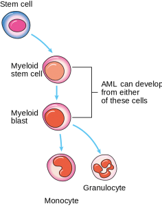 Diagram showing the cells in which AML starts