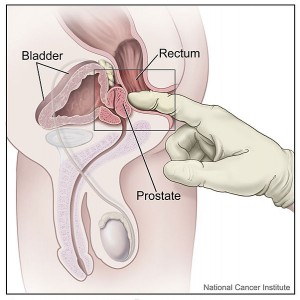 Digital Rectal Exam (Male)