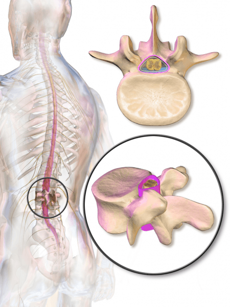 Meninges: Overview on the Structure of the Individual Layers