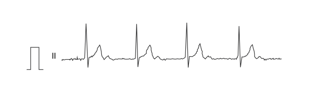 EKG1 EKG1