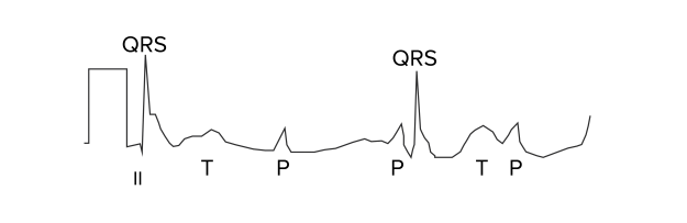 EKG4 EKG4