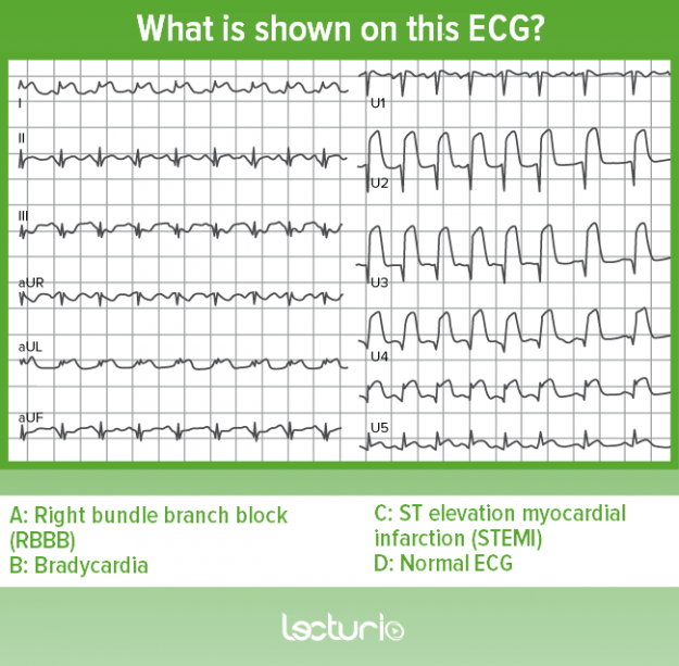 How to Interpret an ECG in Seven Steps Online Medical Library