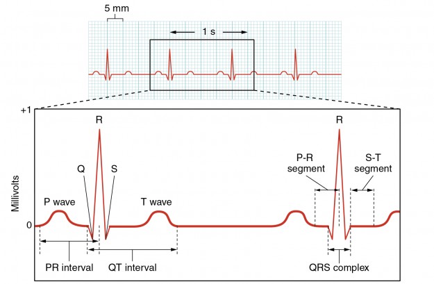 Electrocardiogram