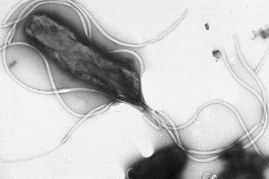 Electron micrograph of H. pylori possessing multiple flagella